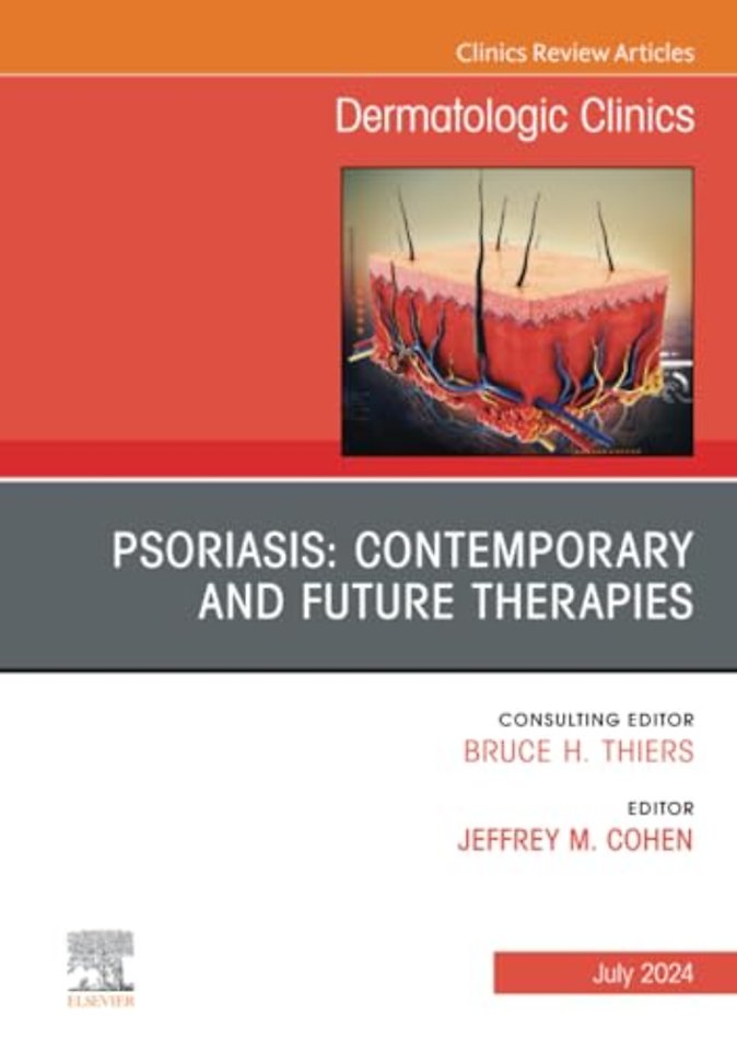 Psoriasis: Contemporary and Future Therapies, An Issue of Dermatologic Clinics
