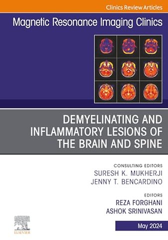 Demyelinating and Inflammatory Lesions of the Brain and Spine, An Issue of Magnetic Resonance Imaging Clinics of North America