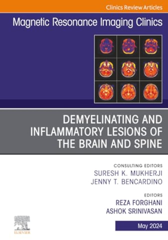Demyelinating and Inflammatory Lesions of the Brain and Spine, An Issue of Magnetic Resonance Imaging Clinics of North America