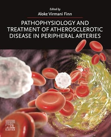 Pathophysiology and Treatment of Atherosclerotic Disease in Peripheral Arteries