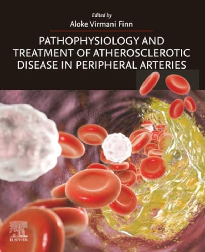 Pathophysiology and Treatment of Atherosclerotic Disease in Peripheral Arteries