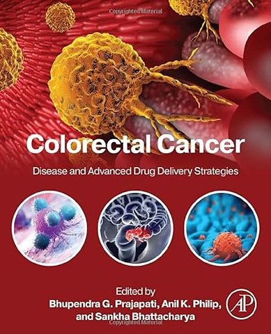 Colorectal Cancer
