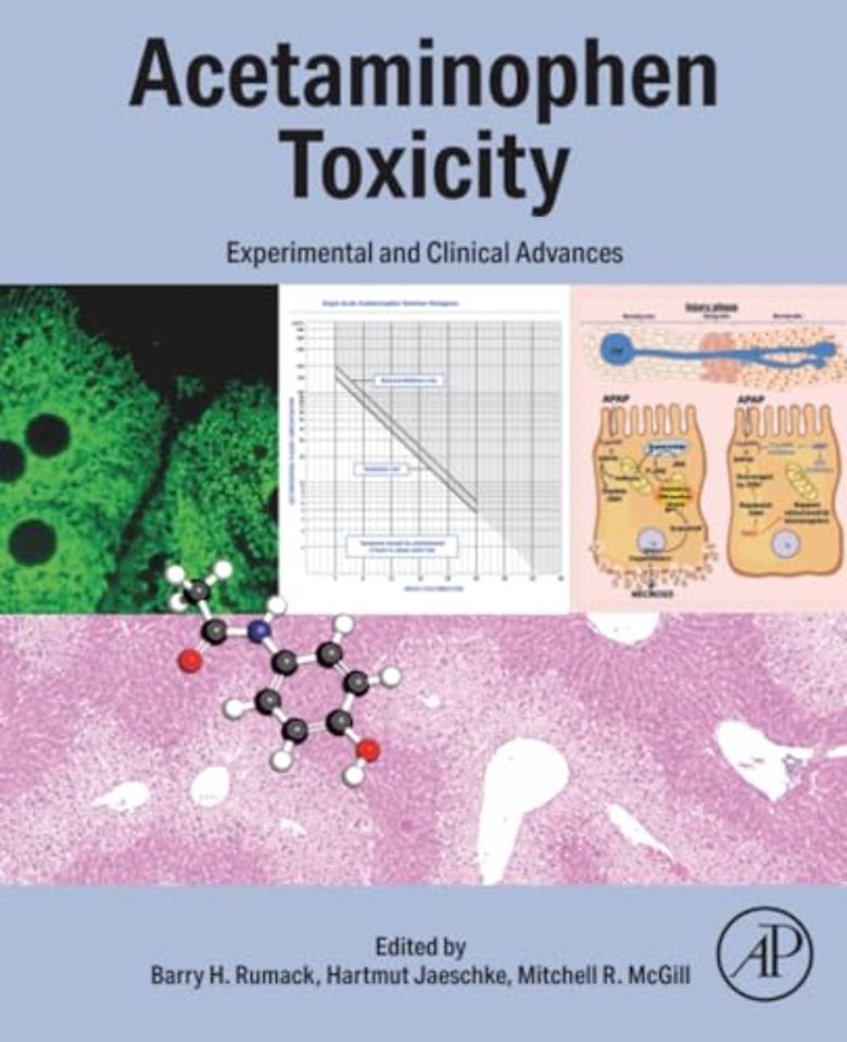 Acetaminophen Toxicity