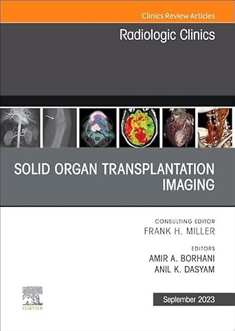 Solid Organ Transplantation Imaging, An Issue of Radiologic Clinics of North America