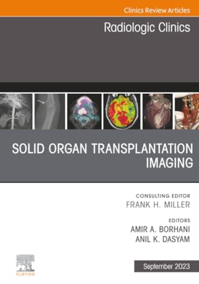 Solid Organ Transplantation Imaging, An Issue of Radiologic Clinics of North America