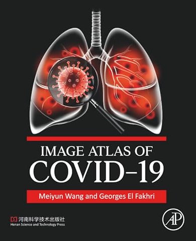 Image Atlas of COVID-19