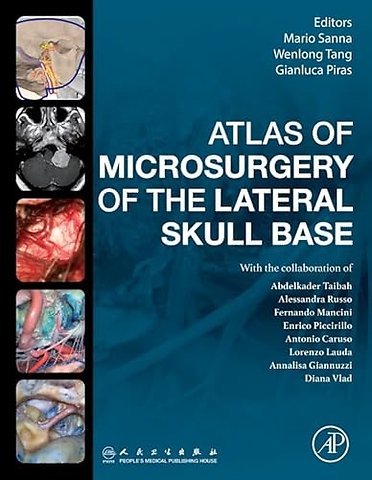Atlas of Microsurgery of the Lateral Skull Base