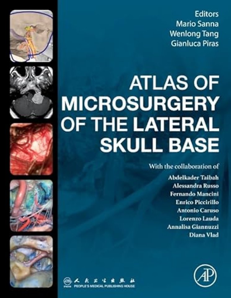 Atlas of Microsurgery of the Lateral Skull Base