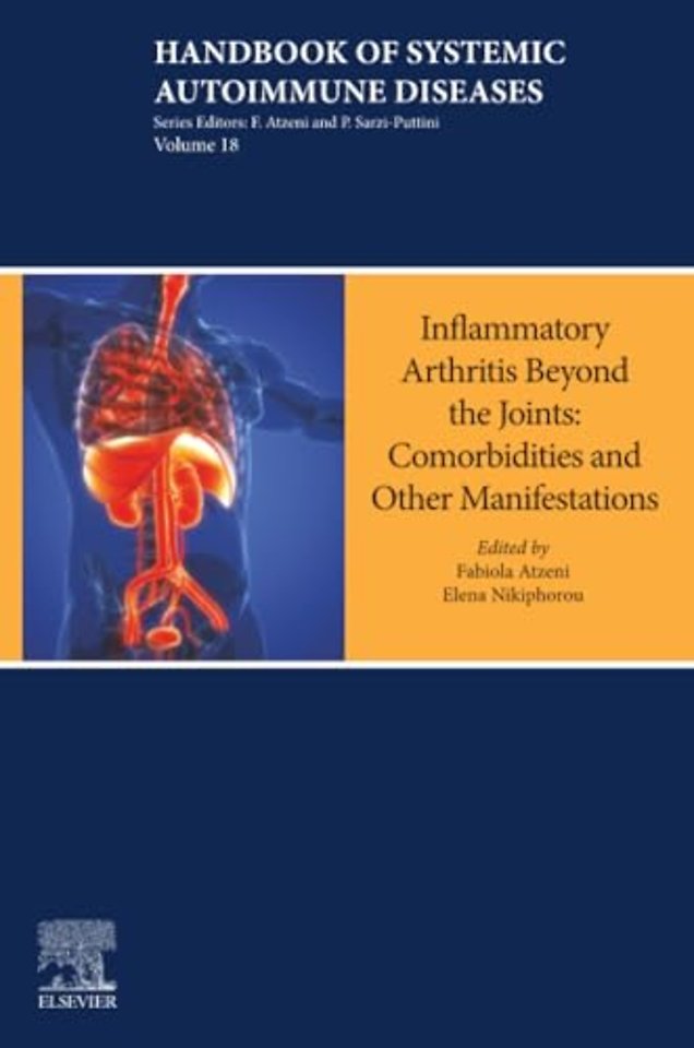 Inflammatory Arthritis Beyond the Joints
