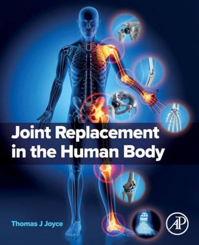 Joint Replacement in the Human Body
