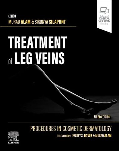 Procedures in Cosmetic Dermatology Series: Treatment of Leg Veins