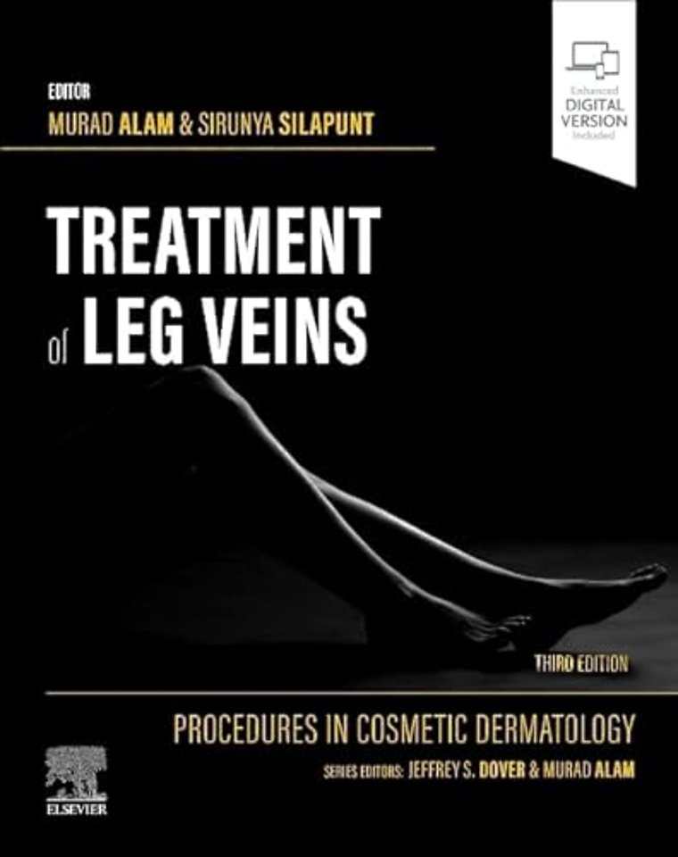 Procedures in Cosmetic Dermatology Series: Treatment of Leg Veins