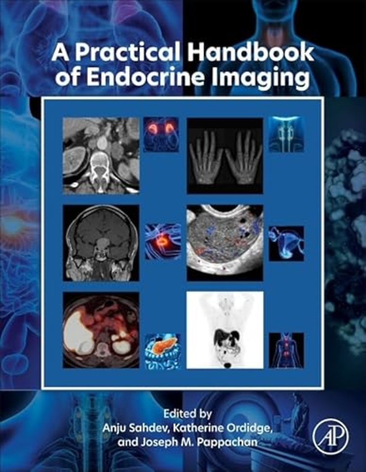 A Practical Handbook of Endocrine Imaging