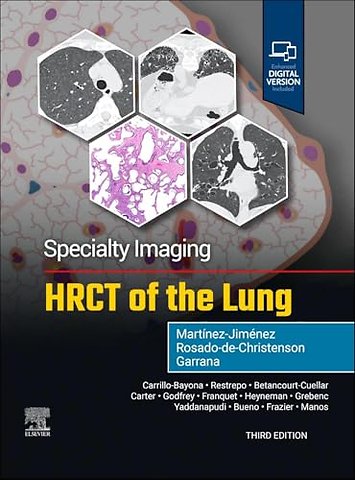 Specialty Imaging: HRCT of the Lung