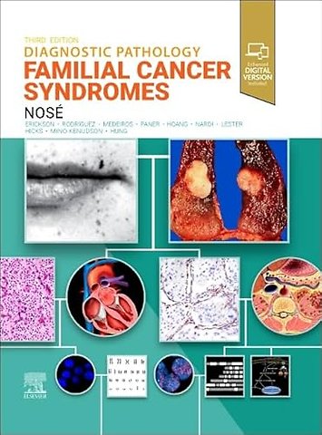 Diagnostic Pathology: Familial Cancer Syndromes