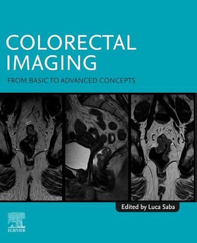 Colorectal Imaging