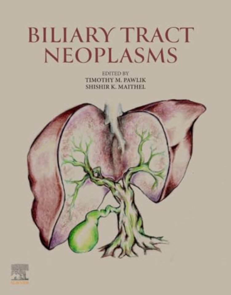 Biliary Tract Neoplasms