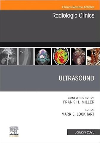Ultrasound, An Issue of Radiologic Clinics of North America