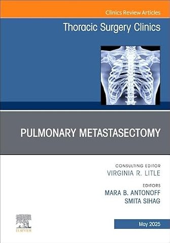 Pulmonary Metastasectomy, An Issue of Thoracic Surgery Clinics