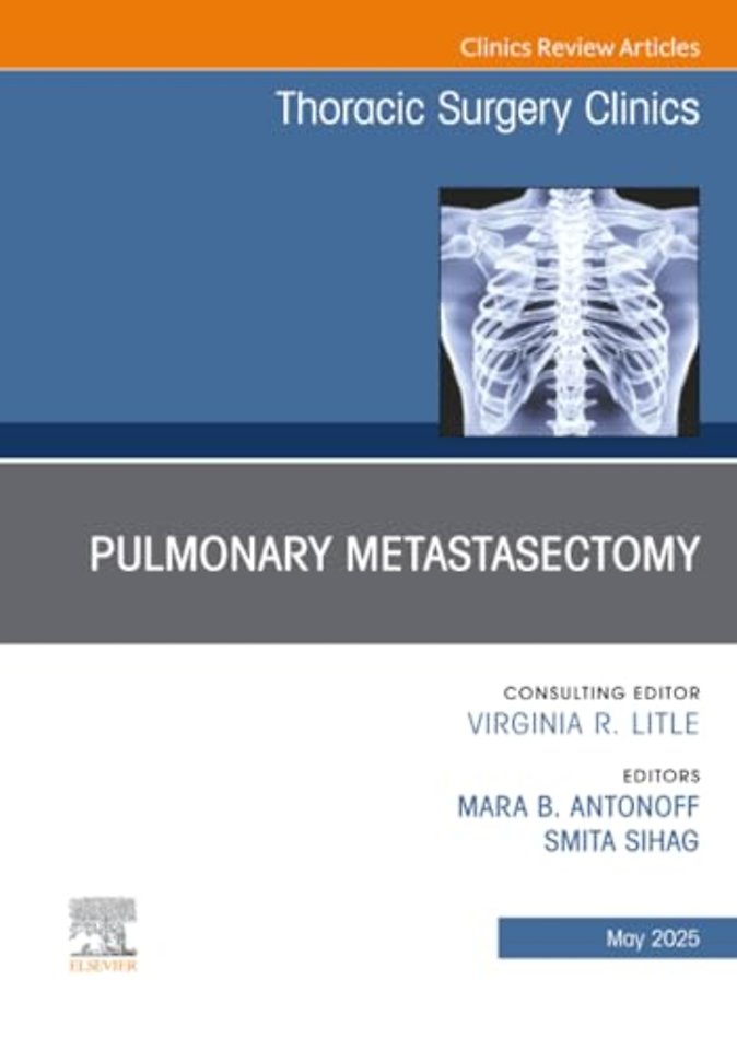 Pulmonary Metastasectomy, An Issue of Thoracic Surgery Clinics