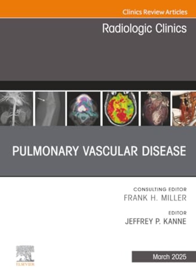 Pulmonary Vascular Disease, An Issue of Radiologic Clinics of North America