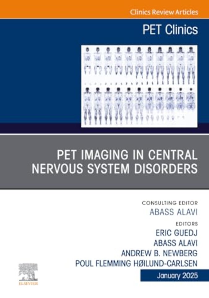 PET Imaging in Central Nervous System Disorders, An Issue of PET Clinics