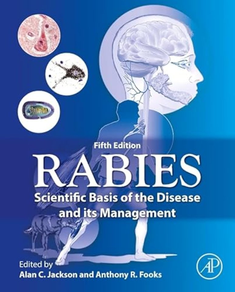 Rabies