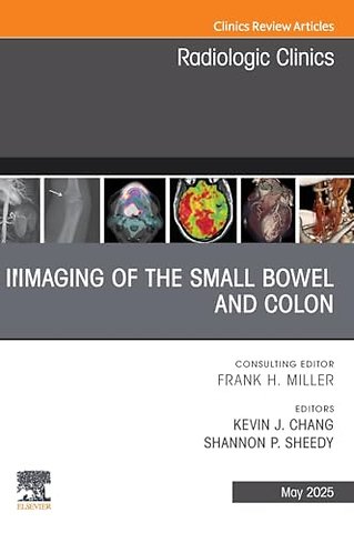 Imaging of the Small Bowel and Colon, An Issue of Radiologic Clinics of North America