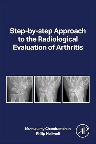 Step-by-step Approach to the Radiological Evaluation of Arthritis