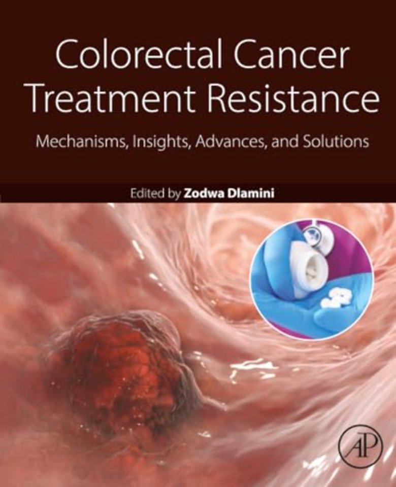 Colorectal Cancer Treatment Resistance