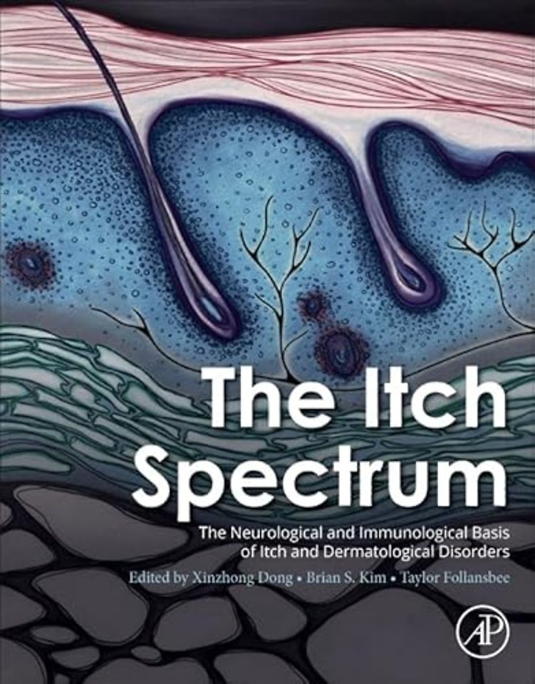 The Itch Spectrum