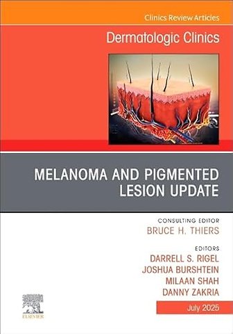 Melanoma and Pigmented Lesion Update, An Issue of Dermatologic Clinics