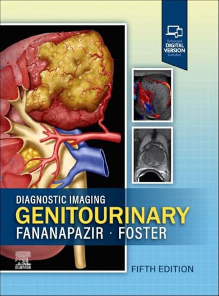 Diagnostic Imaging: Genitourinary