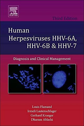 Human Herpesviruses HHV-6A, HHV-6B and HHV-7