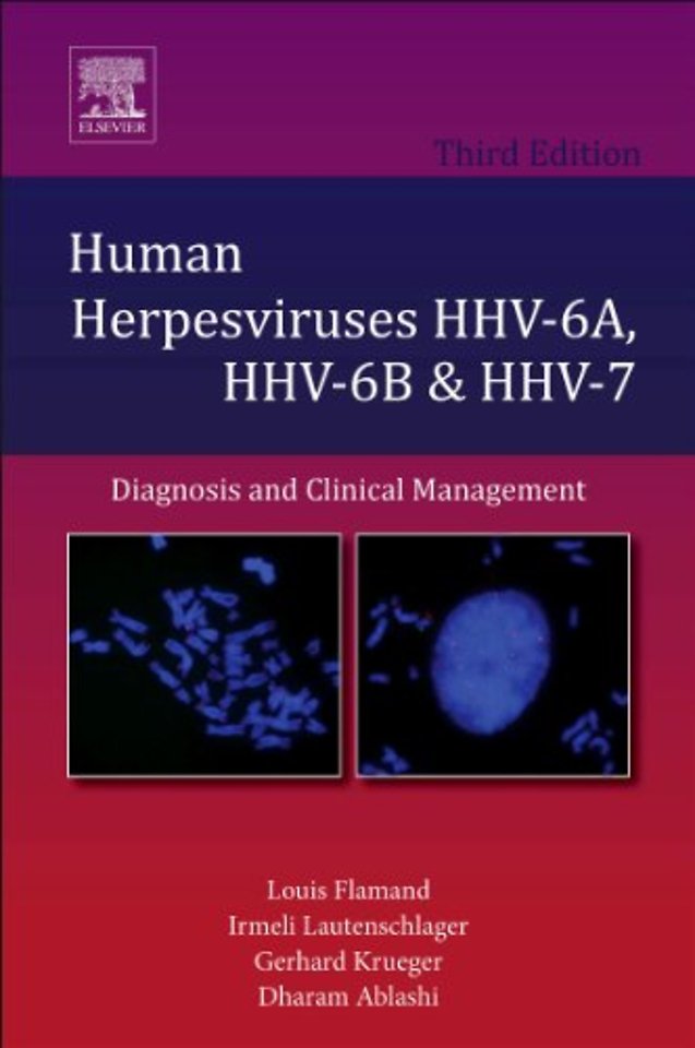 Human Herpesviruses HHV-6A, HHV-6B and HHV-7