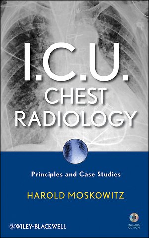 I.C.U. Chest Radiology – Principles and Case Studies +CD