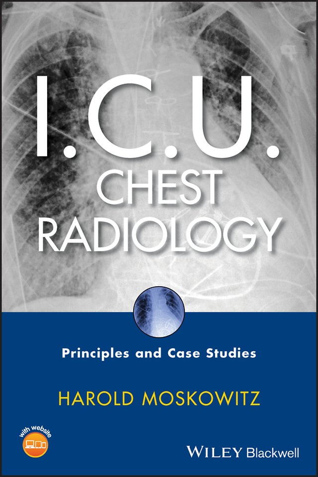 I.C.U. Chest Radiology – Principles and Case Studies +CD