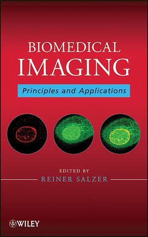 Biomedical Imaging – Principles and Applications