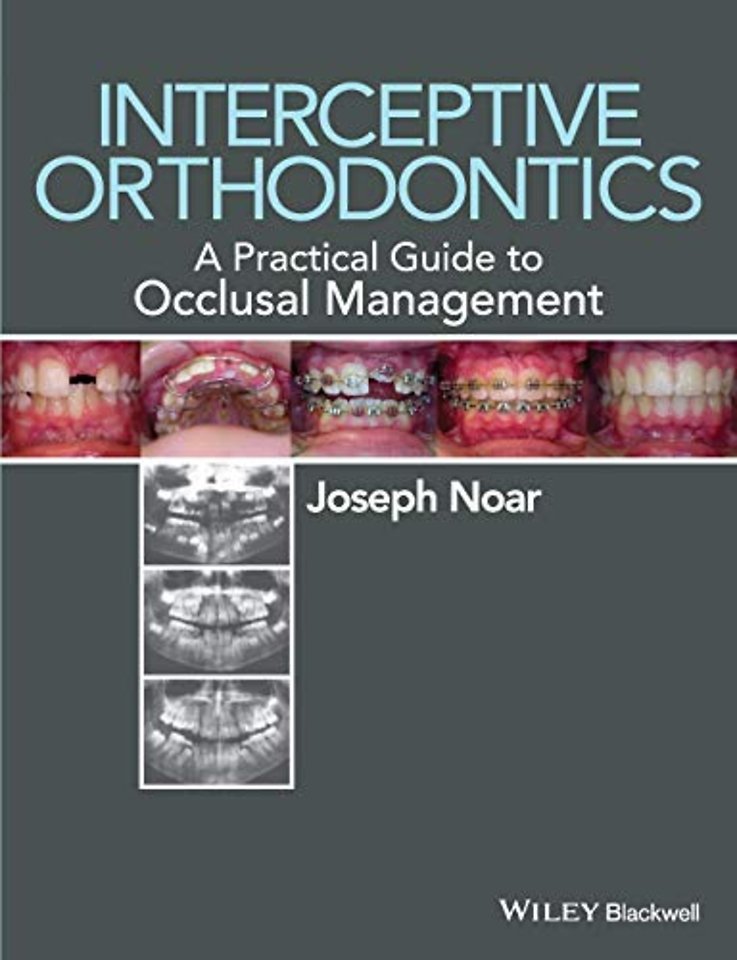 Interceptive Orthodontics