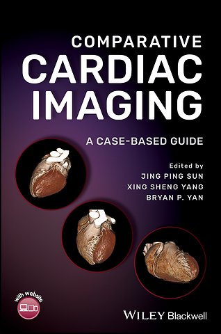 Comparative Cardiac Imaging – A Case–based Guide