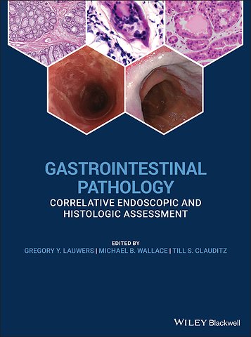 Gastrointestinal Pathology – Correlative Endoscopic and Histologic Assessment