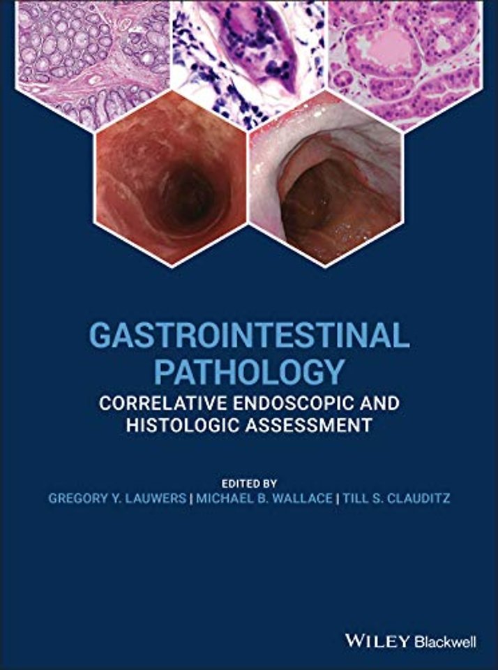 Gastrointestinal Pathology – Correlative Endoscopic and Histologic Assessment
