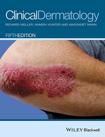 Clinical Dermatology