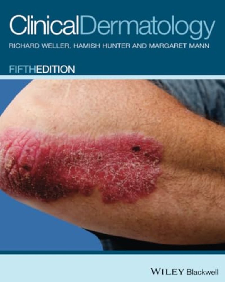 Clinical Dermatology
