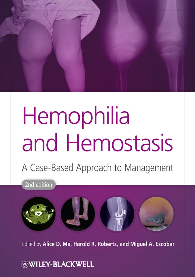 Hemophilia and Hemostasis – A Case–Based Approach to Management 2e
