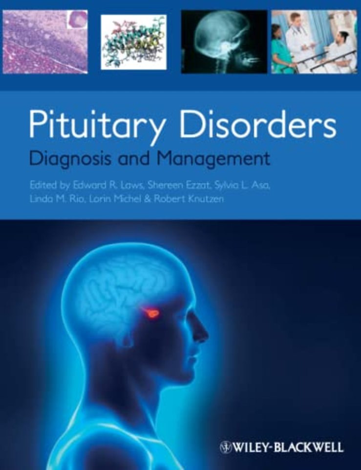 Pituitary Disorders