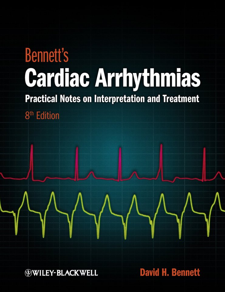 Bennett′s Cardiac Arrhythmias – Practical Notes on Interpretation and Treatment 8e