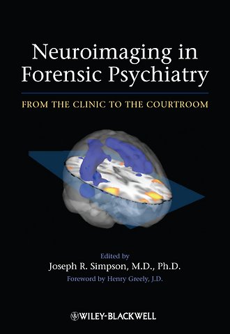 Neuroimaging in Forensic Psychiatry – From the Clinic to the Courtroom