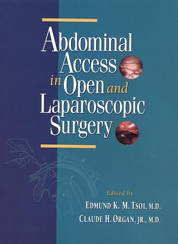 Abdominal Access in Open and Laparoscopic Surgery