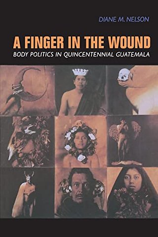 A Finger in the Wound